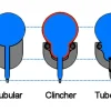 What is a Clincher Tire? A Comprehensive Guide to Understanding This Essential Bike Component